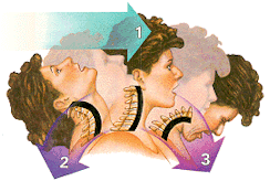 Whiplash Injury To Neck